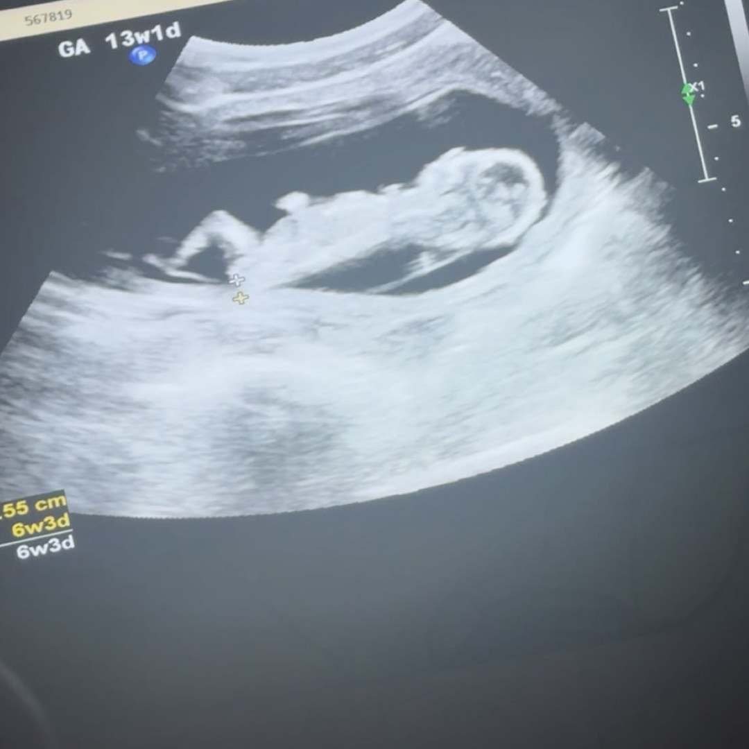 Photo shared by Shamecca for their Babylist baby registry.