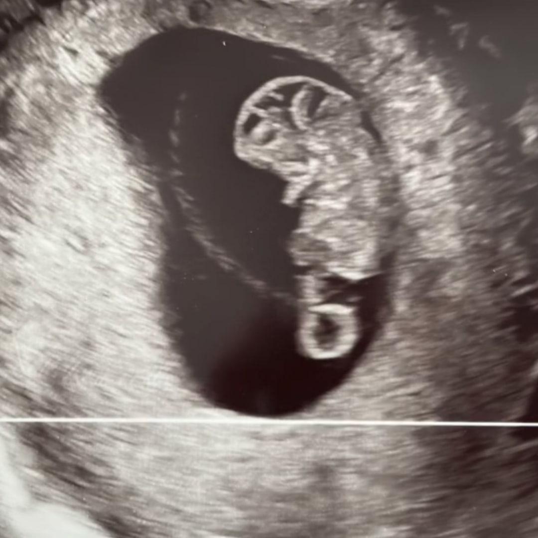 Photo shared by Katie for their Babylist baby registry.