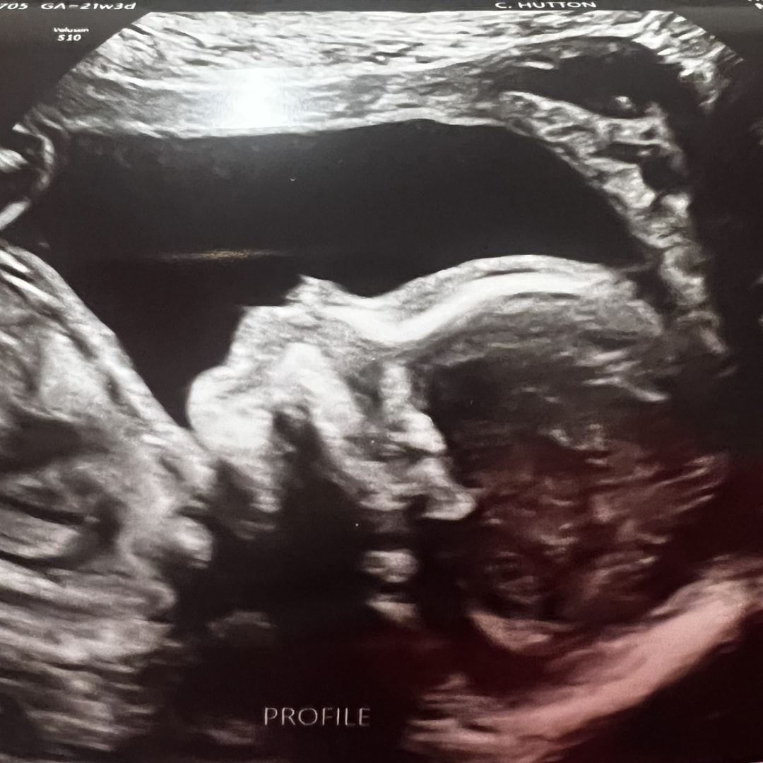 Photo shared by Elysia for their Babylist baby registry.