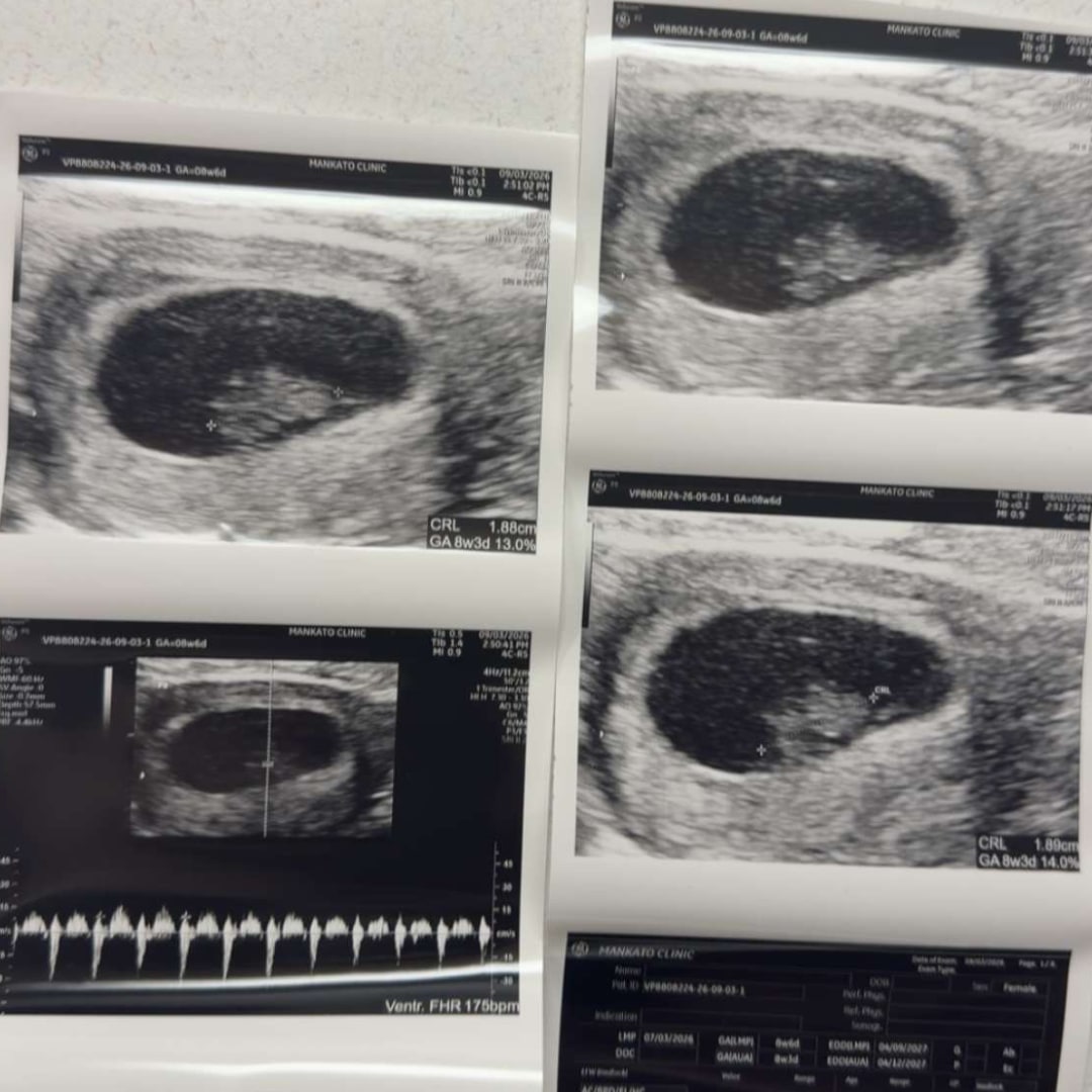 Photo shared by Allison for their Babylist baby registry.