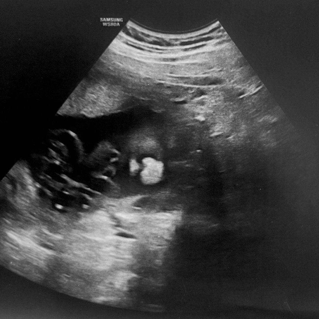 Photo shared by Heaven for their Babylist baby registry.