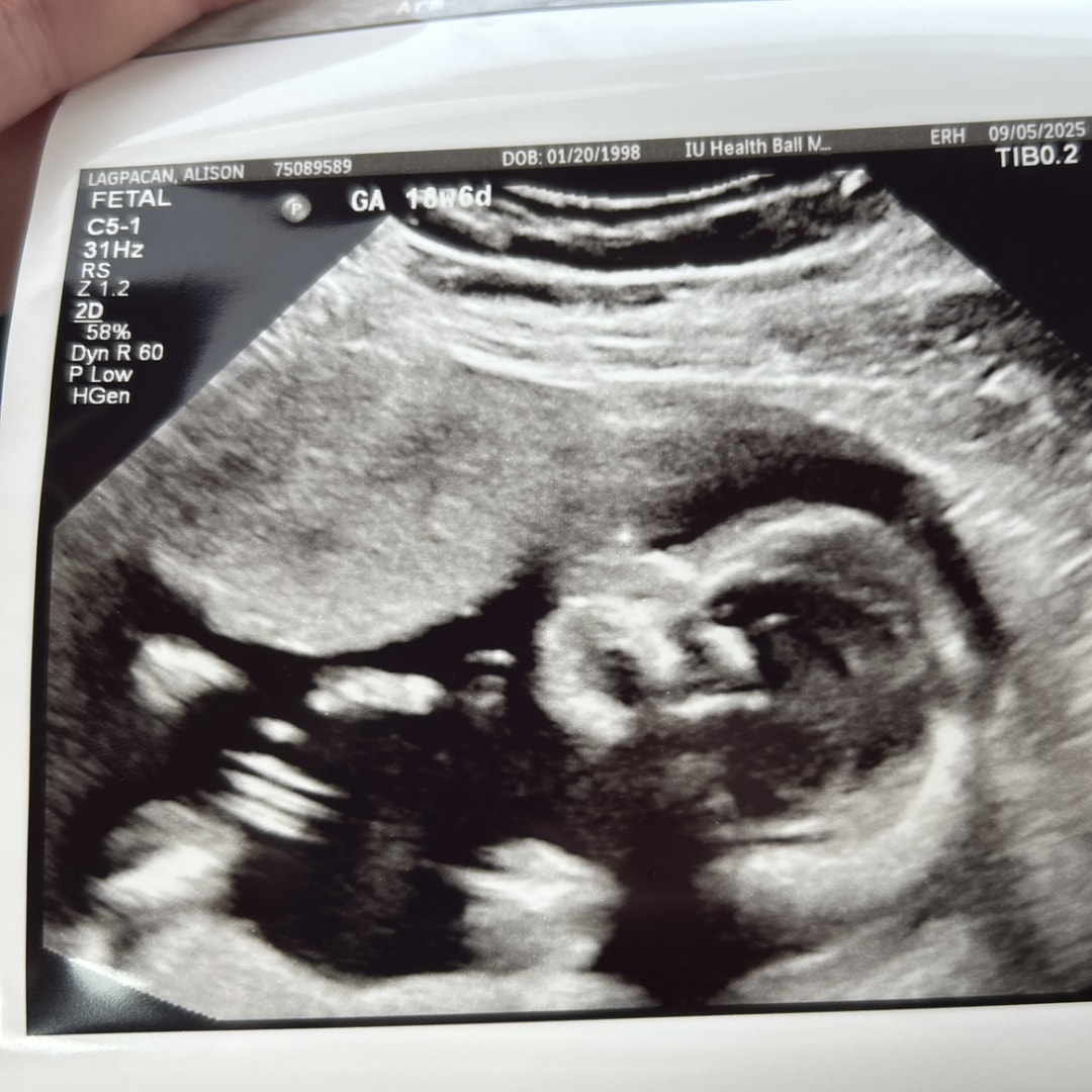 Photo shared by Alison for their Babylist baby registry.
