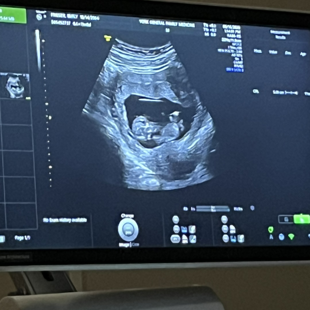 Photo shared by Christian for their Babylist baby registry.