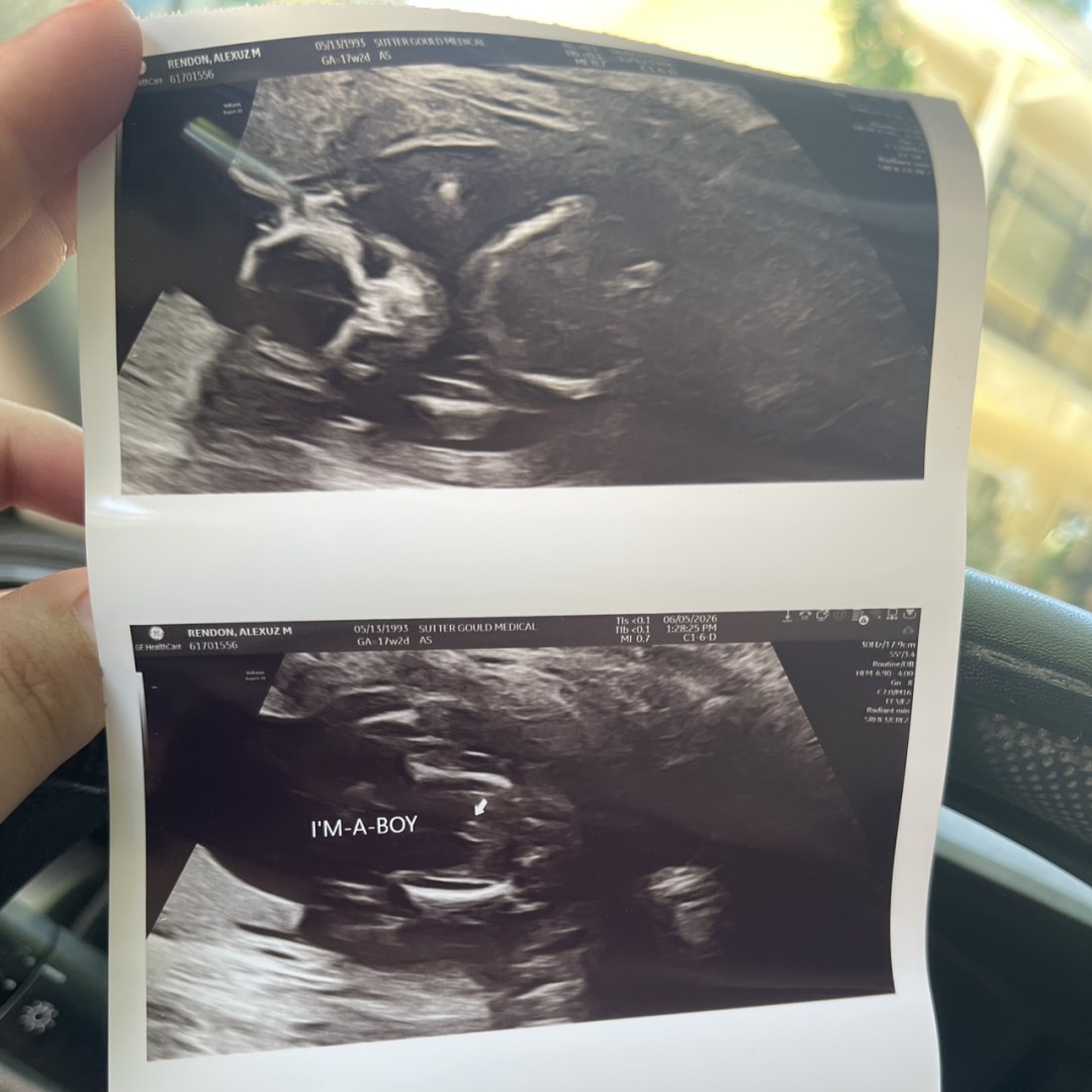 Photo shared by Alexuz for their Babylist baby registry.