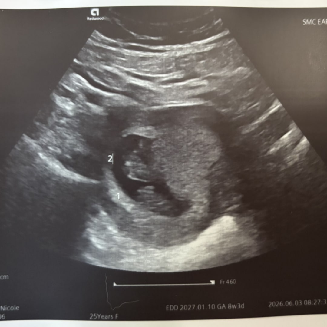 Photo shared by Alexis for their Babylist baby registry.
