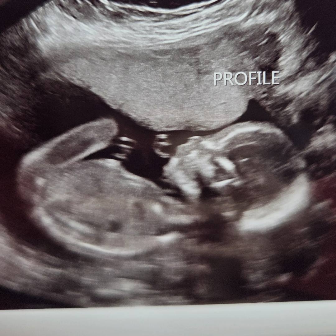 Photo shared by Carrie for their Babylist baby registry.