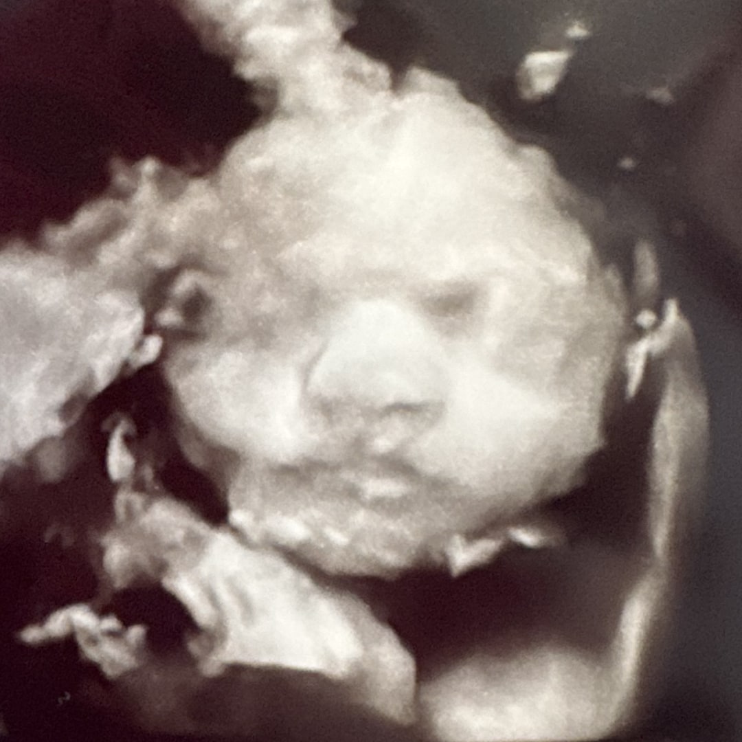 Photo shared by Emily for their Babylist baby registry.