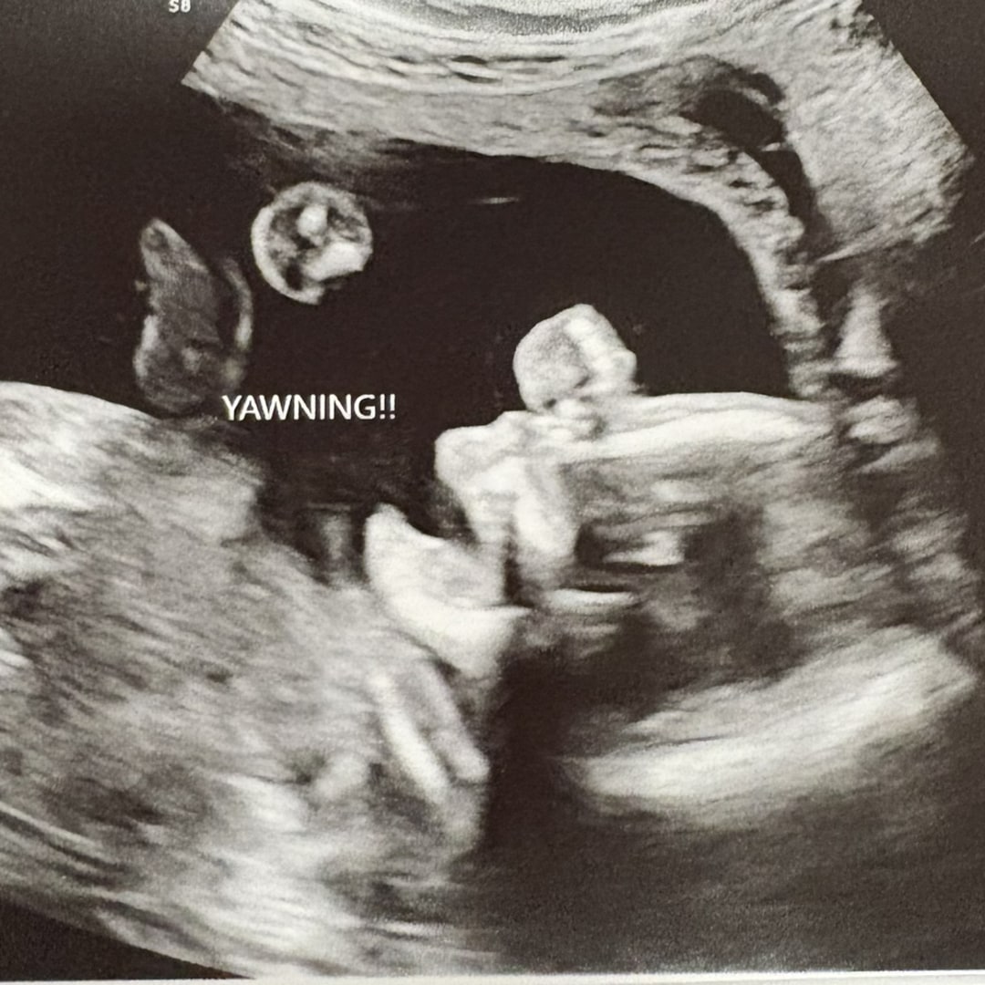 Photo shared by Emerald for their Babylist baby registry.