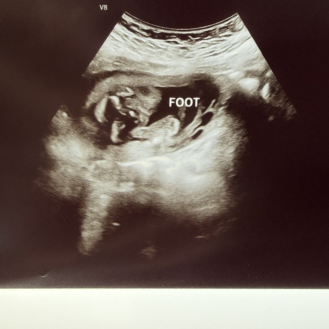 Photo shared by Hayley for their Babylist baby registry.