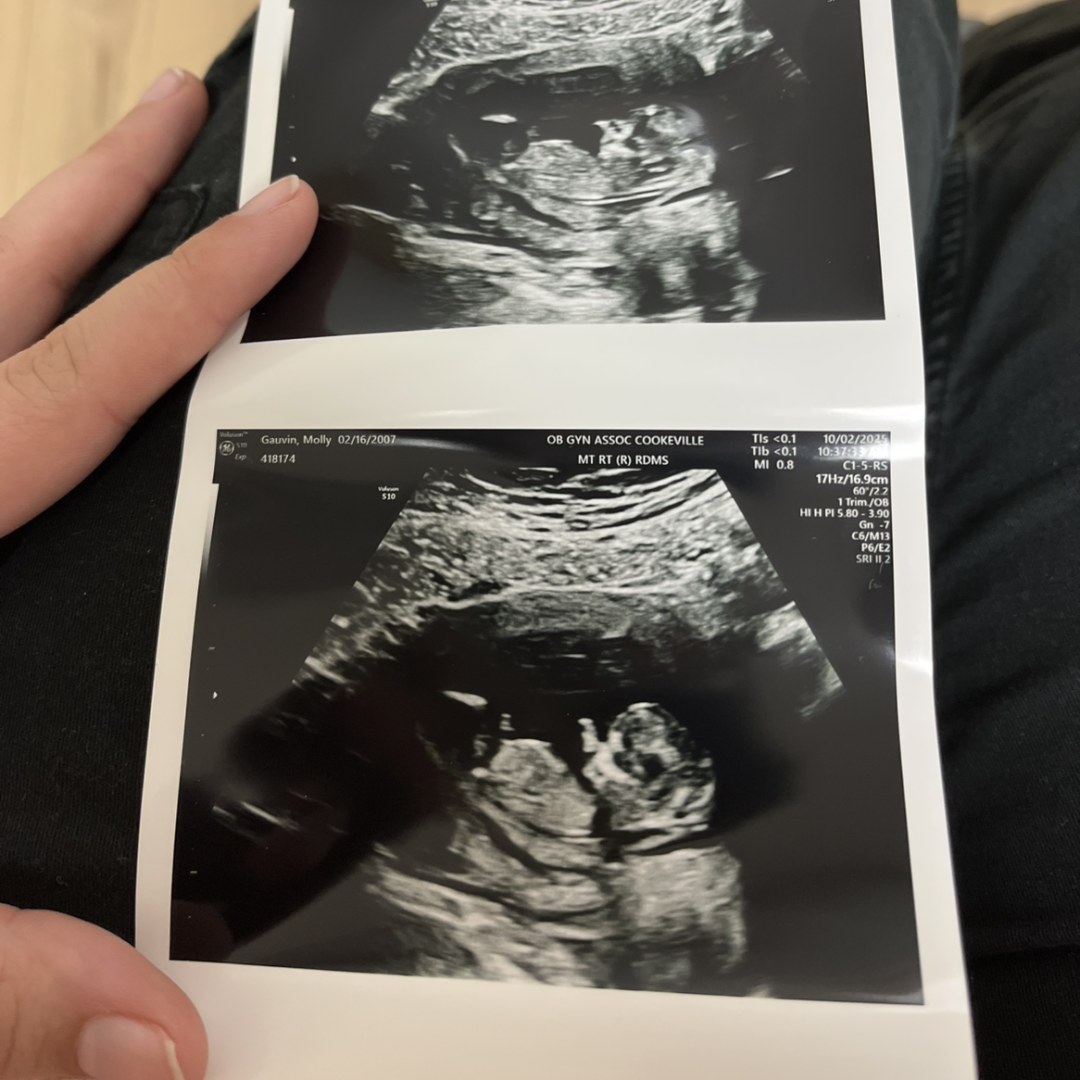 Photo shared by Molly for their Babylist baby registry.