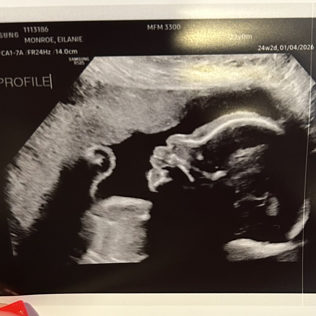 Photo shared by Eilanie for their Babylist baby registry.