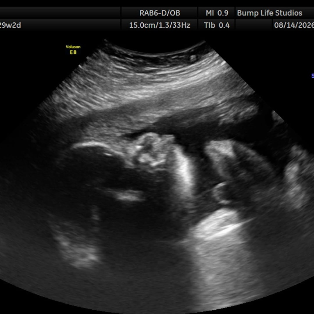 Photo shared by Brittney for their Babylist baby registry.