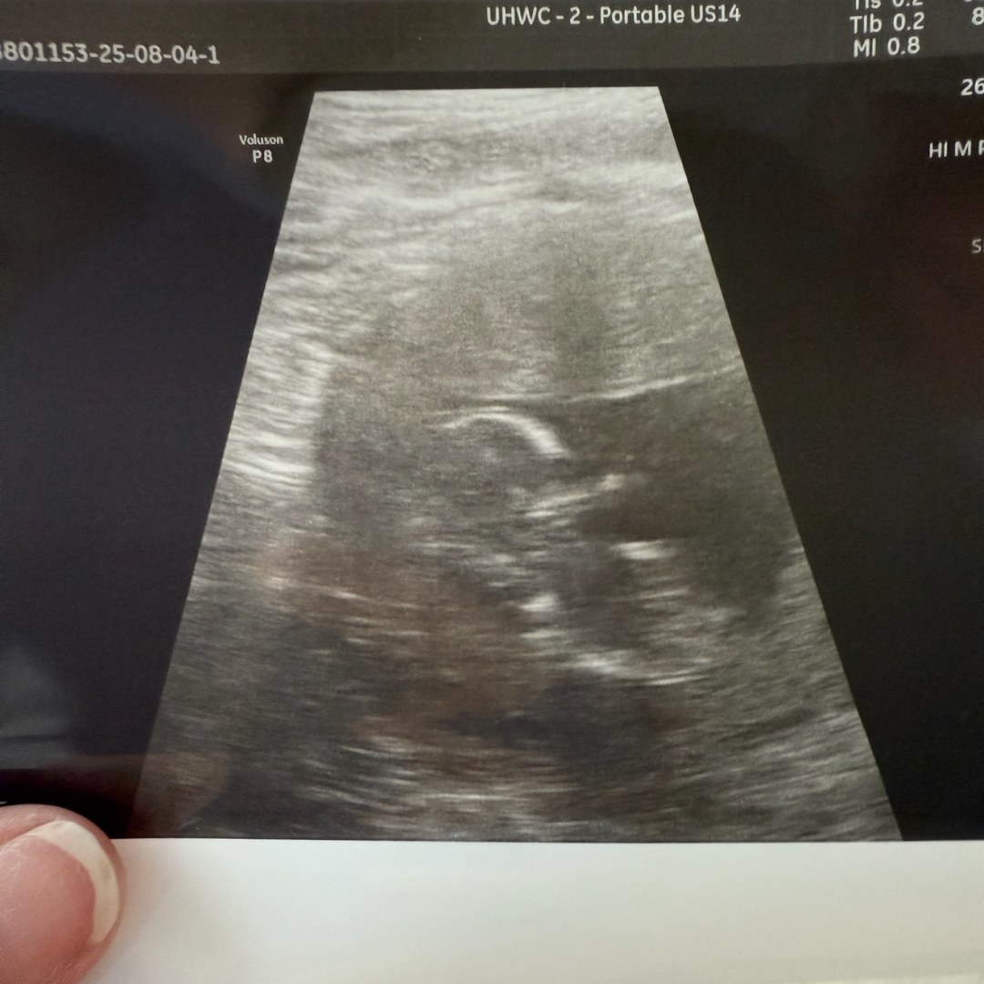Photo shared by Morgan for their Babylist baby registry.