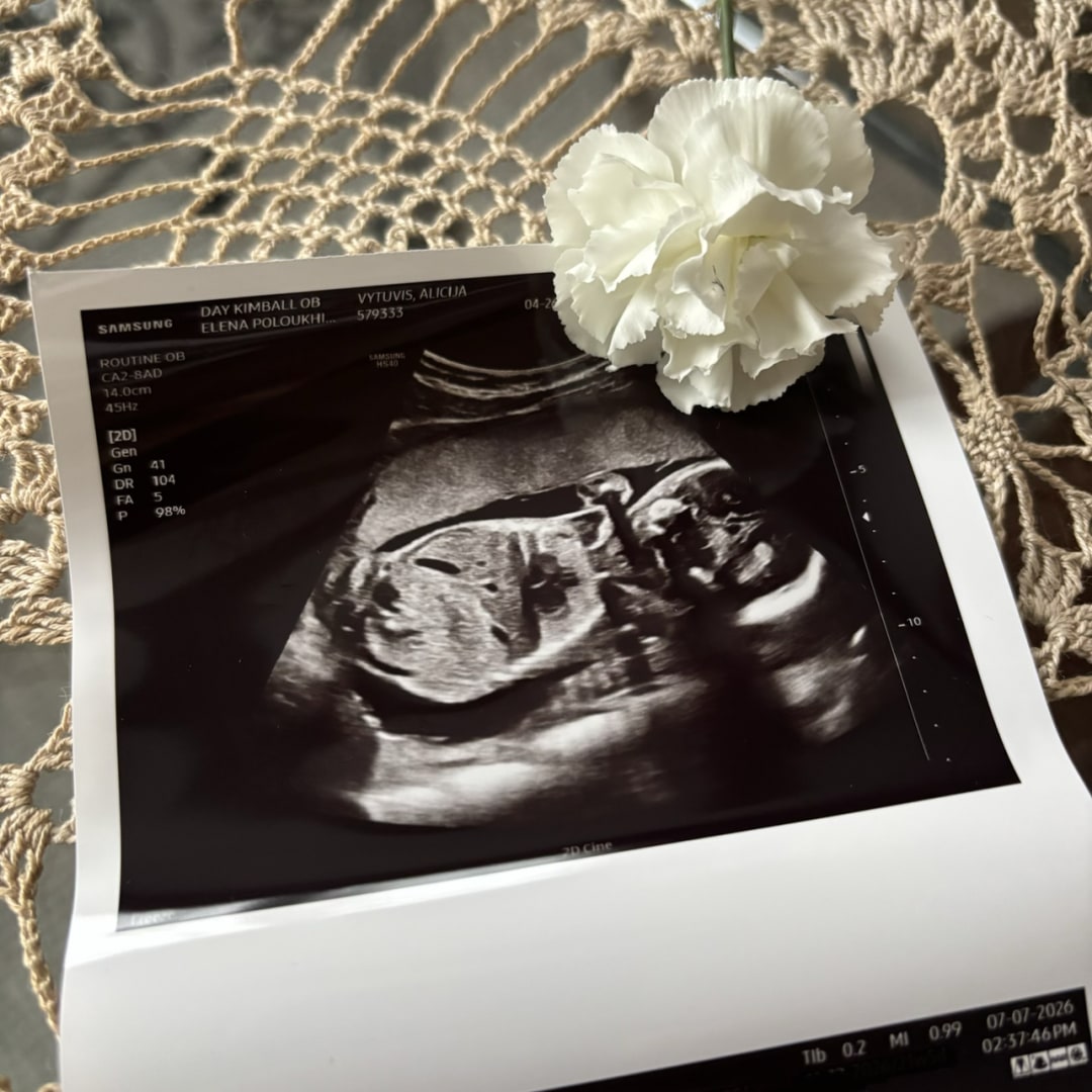 Photo shared by Alicija for their Babylist baby registry.