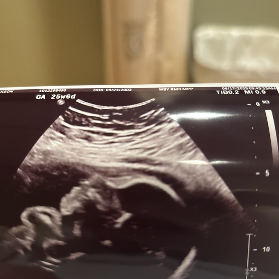 Photo shared by Madison for their Babylist baby registry.
