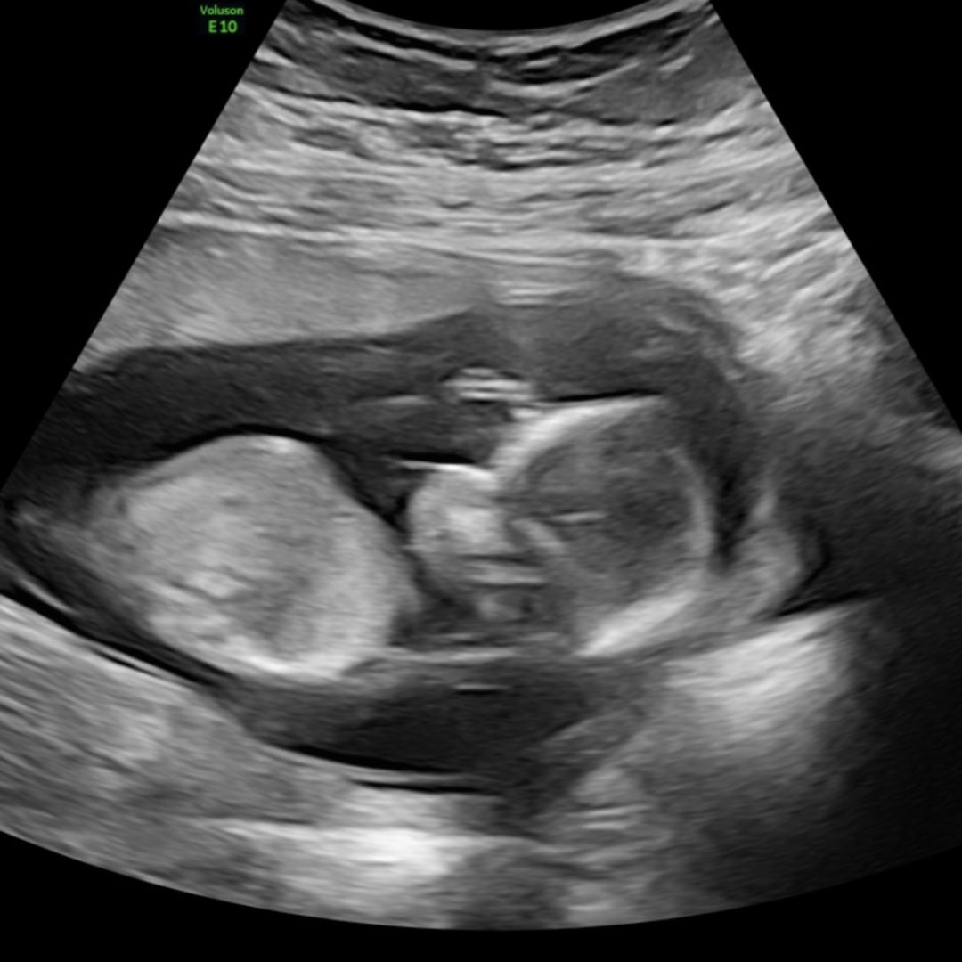 Photo shared by Kaylee & Max for their Babylist baby registry.