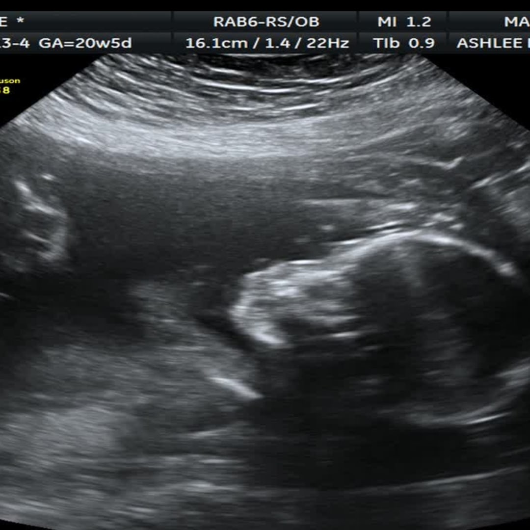 Photo shared by Gabrielle for their Babylist baby registry.