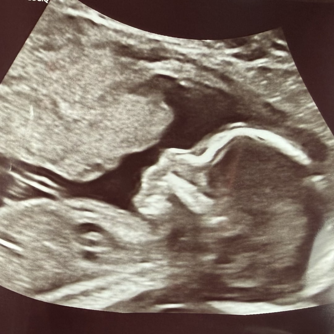 Photo shared by Audrey for their Babylist baby registry.