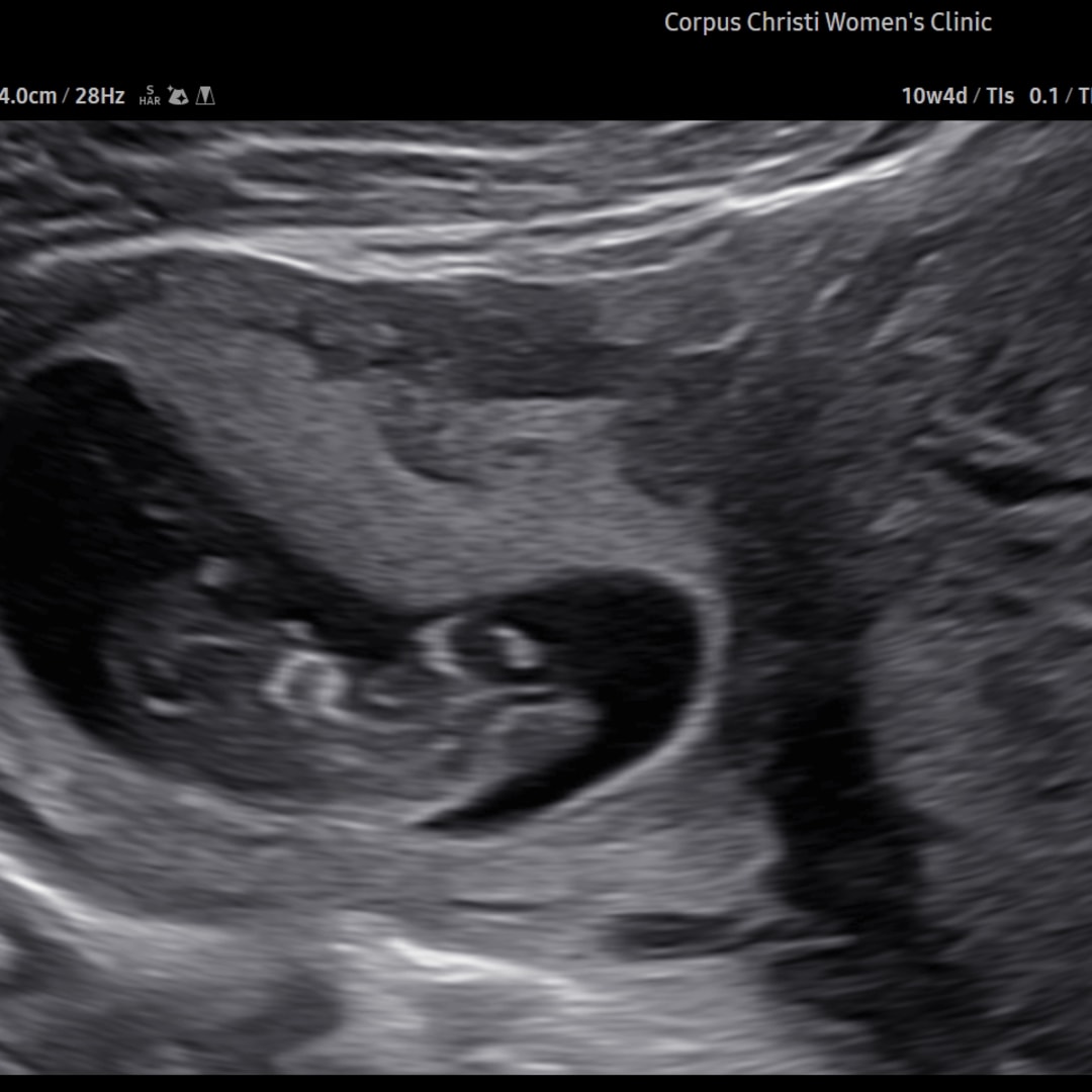 Photo shared by Amber for their Babylist baby registry.