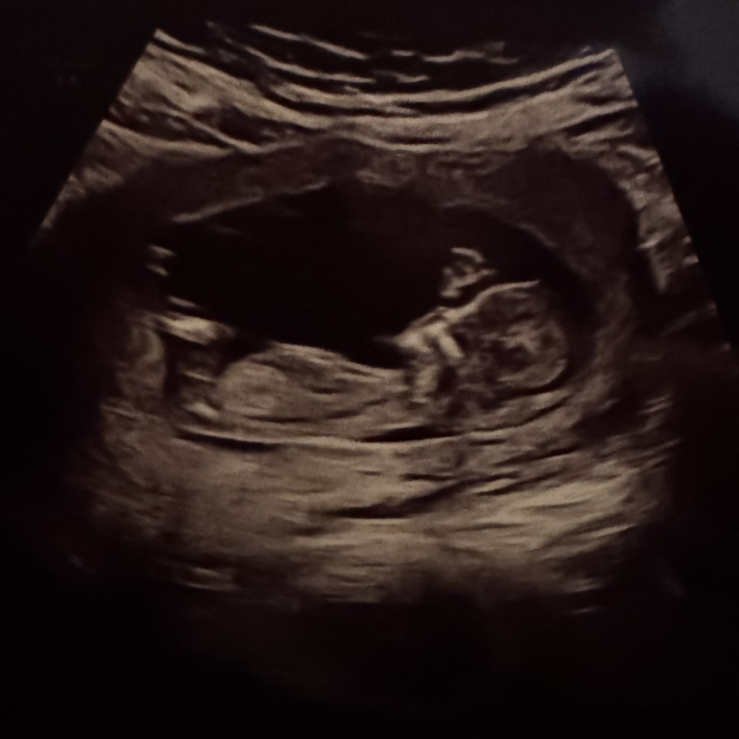 Photo shared by Vanessa for their Babylist baby registry.
