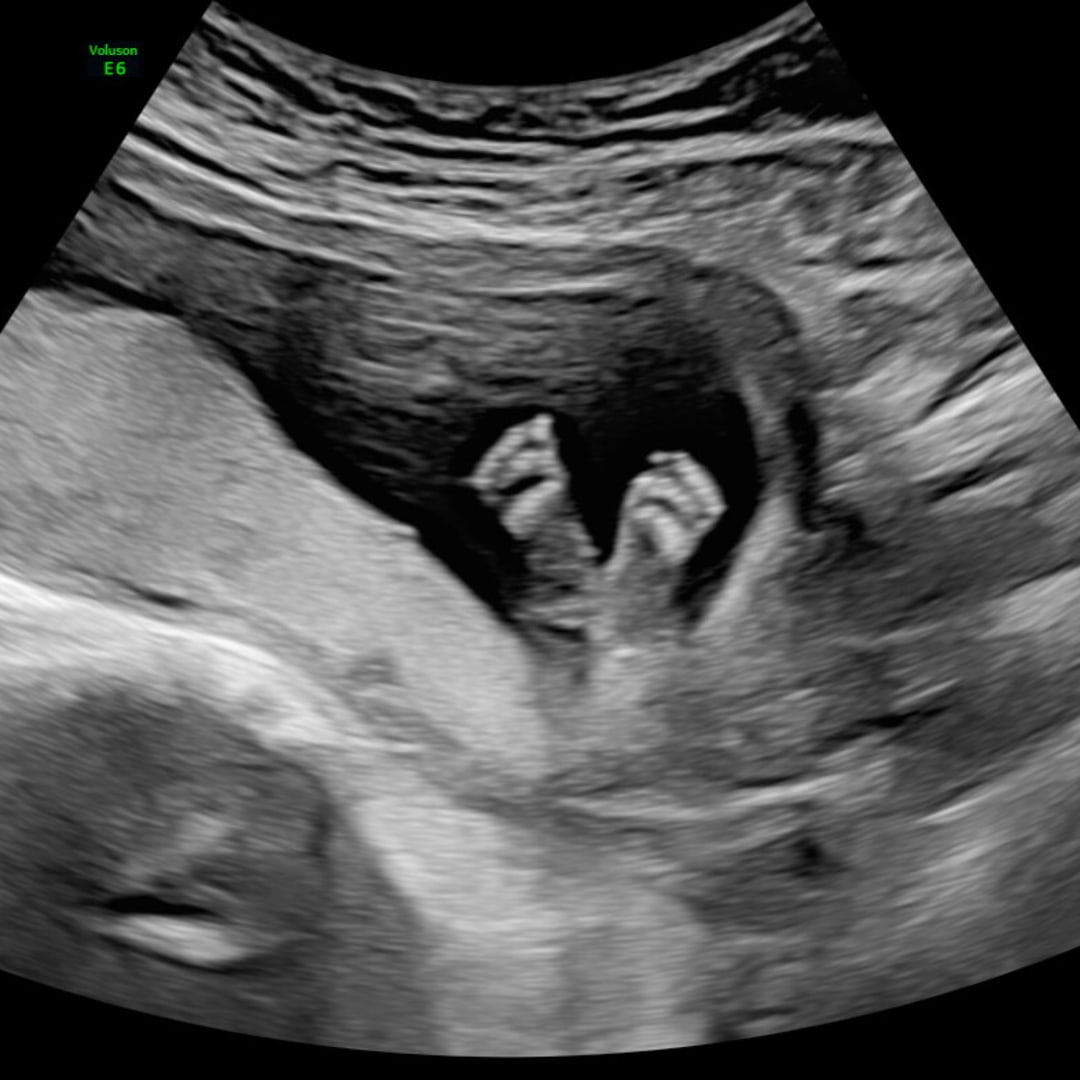 Photo shared by Vada for their Babylist baby registry.