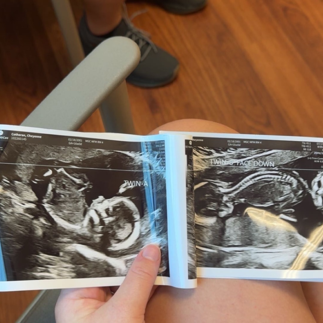 Photo shared by Cheyenne for their Babylist baby registry.