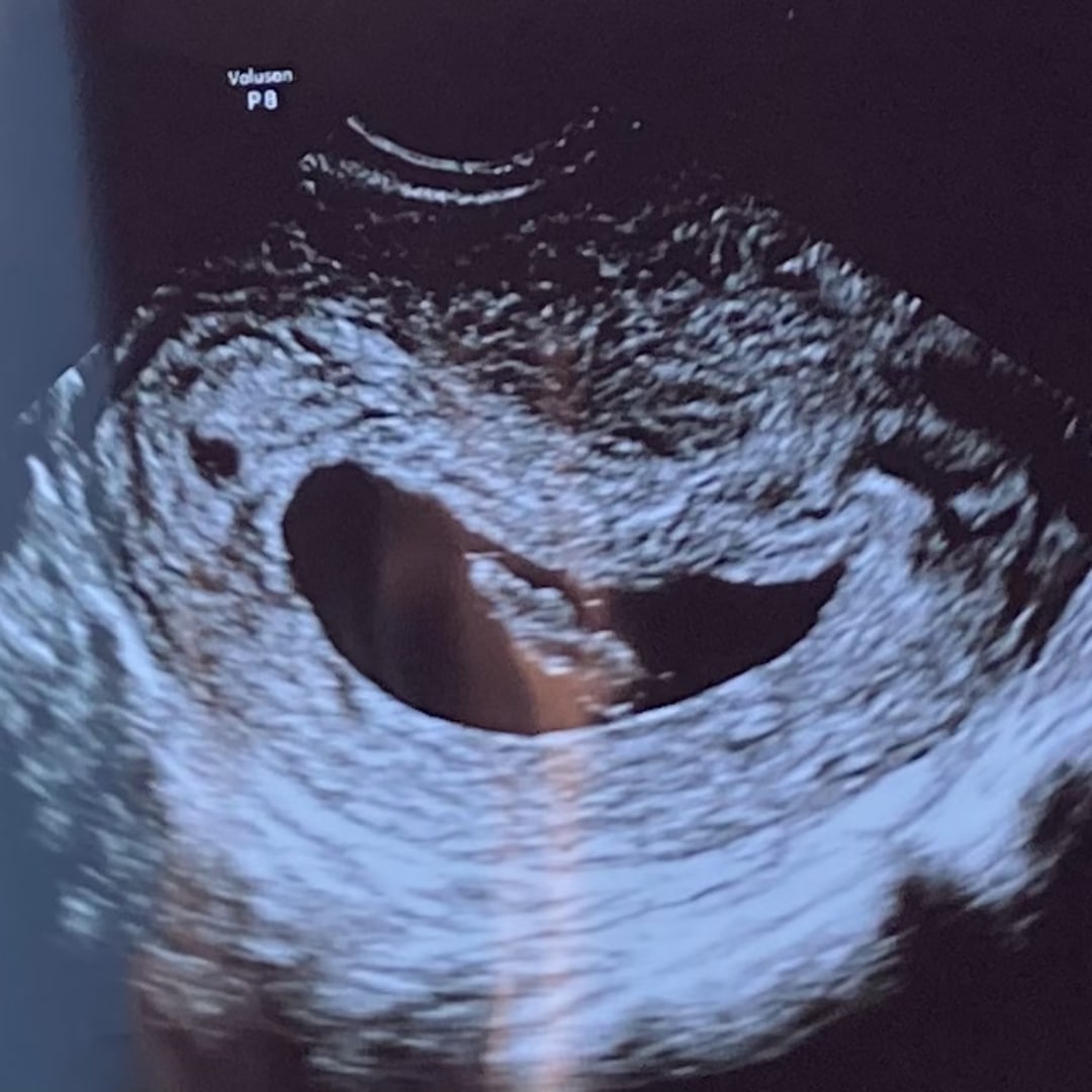 Photo shared by Dani for their Babylist baby registry.