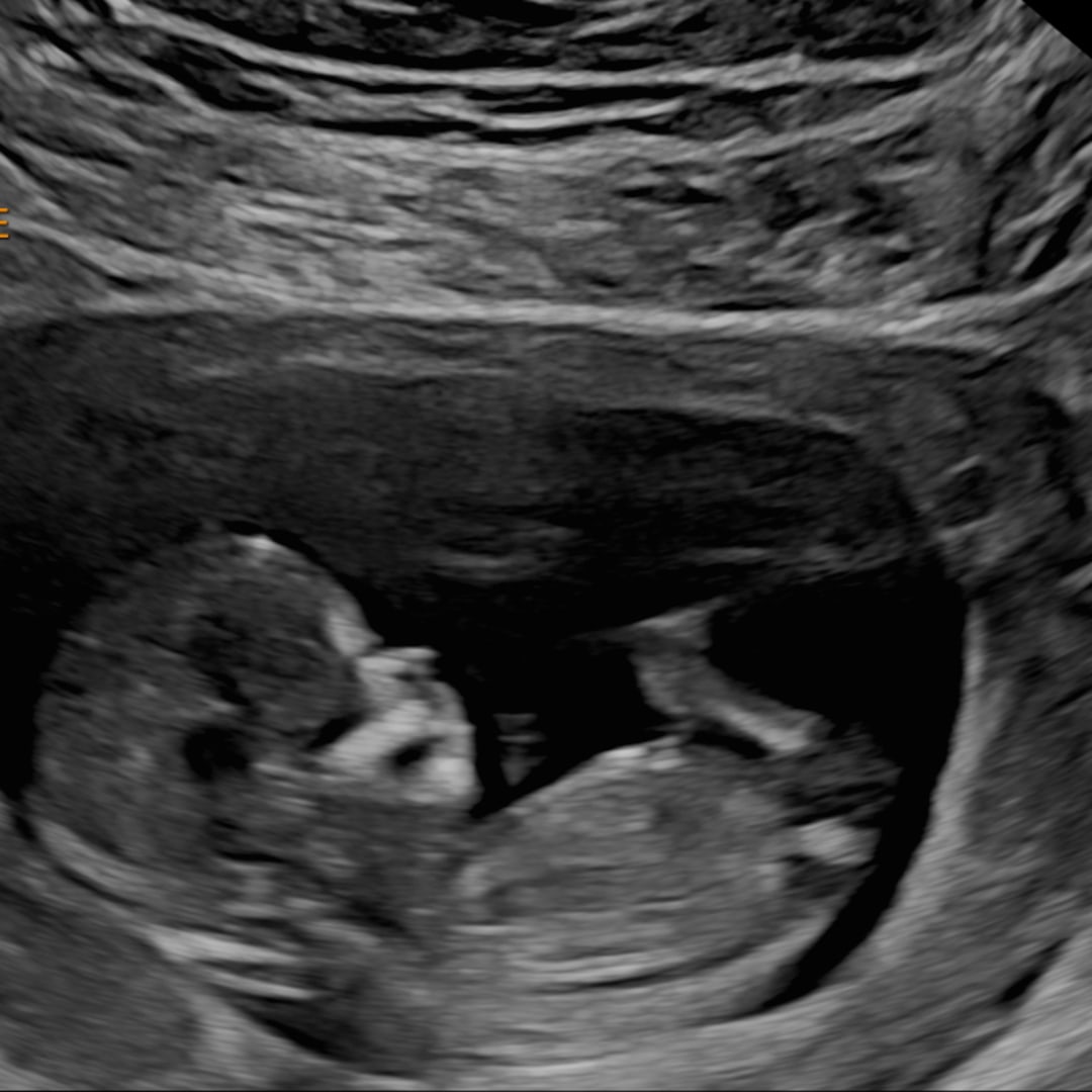 Photo shared by Morgan for their Babylist baby registry.