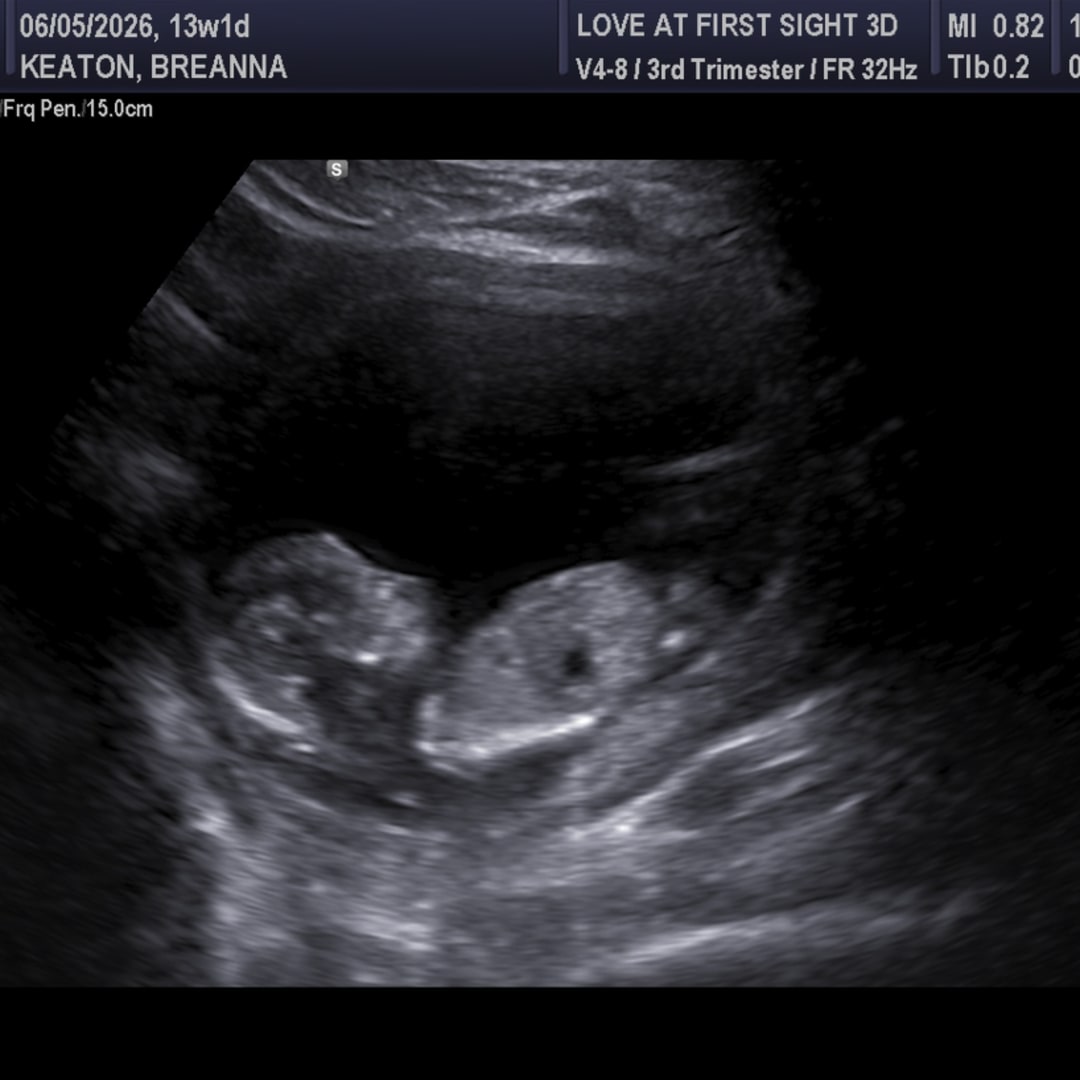 Photo shared by Breanna for their Babylist baby registry.