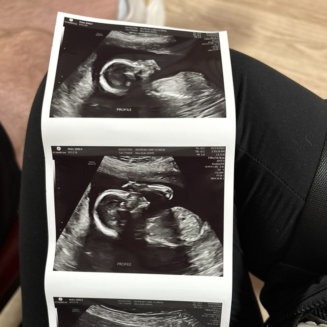 Photo shared by Emily for their Babylist baby registry.