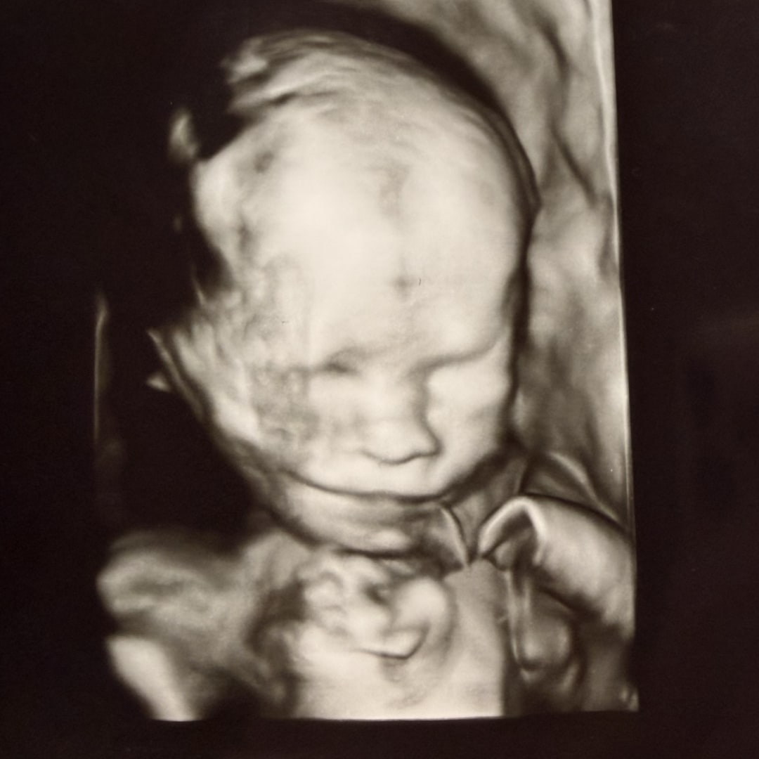 Photo shared by Bindi for their Babylist baby registry.
