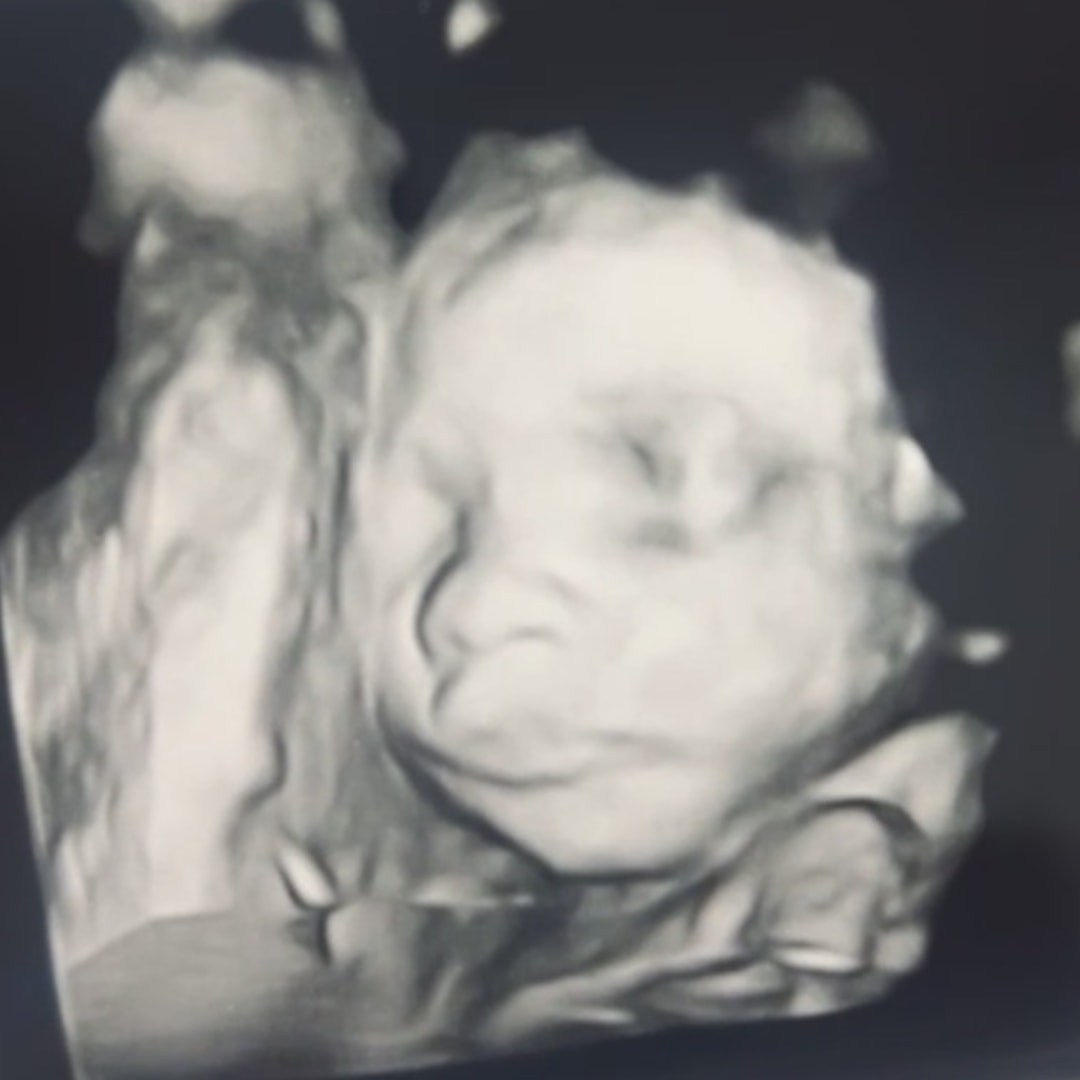 Photo shared by Hayla for their Babylist baby registry.