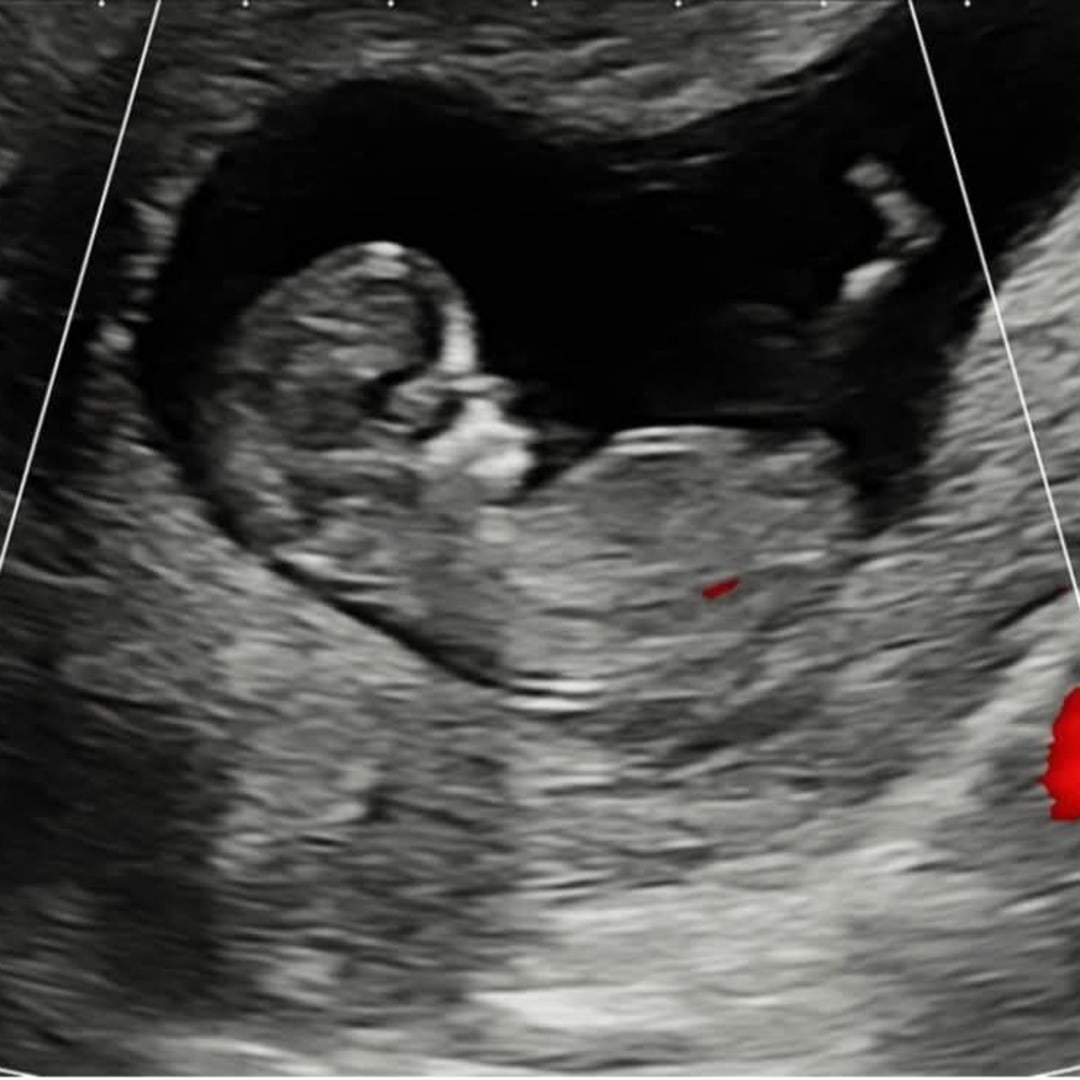 Photo shared by Alejandro for their Babylist baby registry.