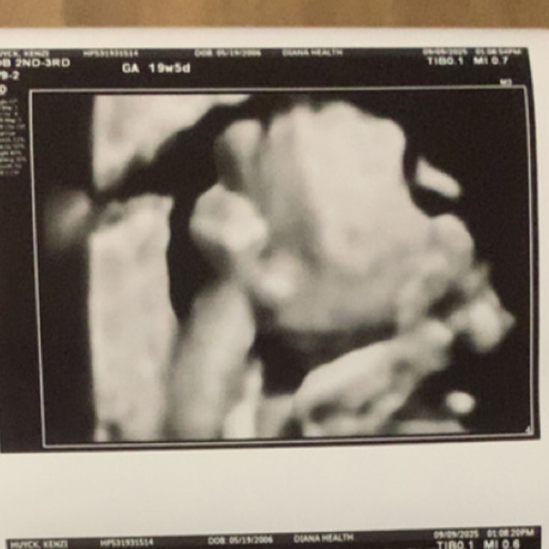 Photo shared by Kenzi for their Babylist baby registry.