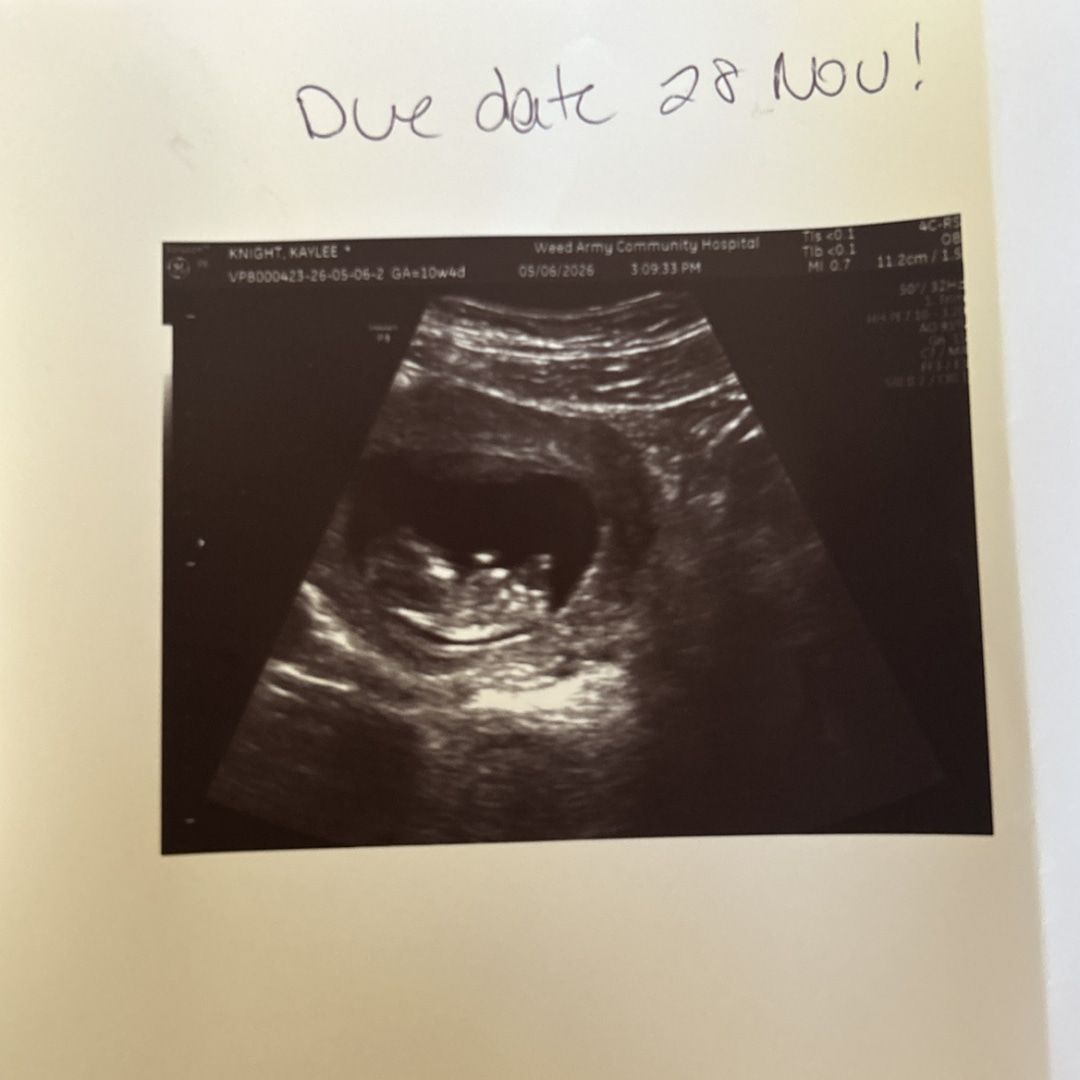 Photo shared by Kaylee for their Babylist baby registry.