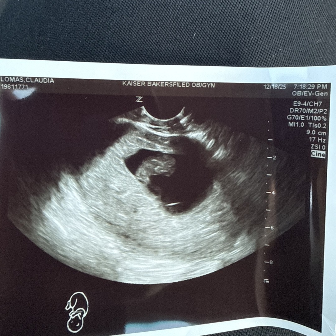 Photo shared by Claudia for their Babylist baby registry.