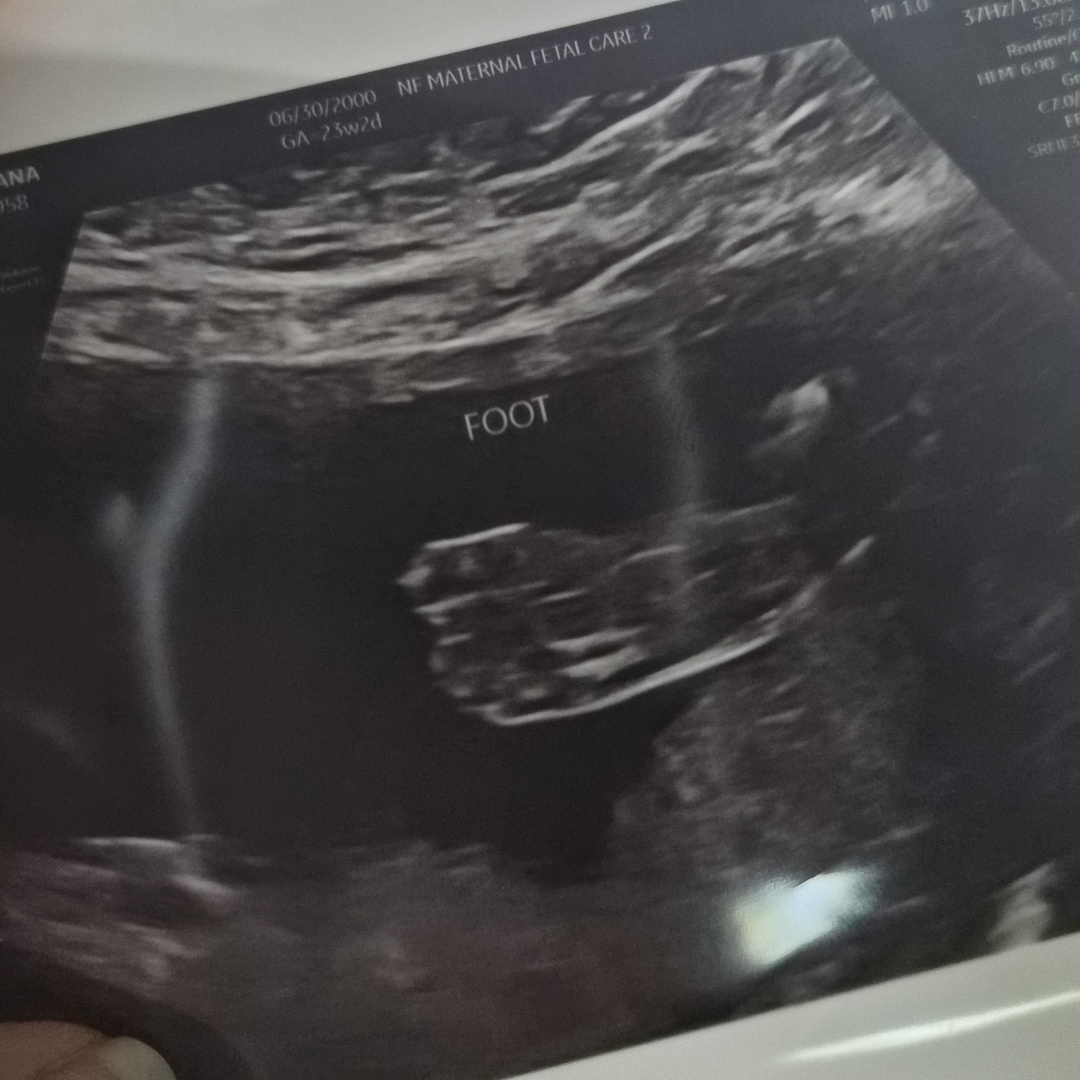 Photo shared by Ana for their Babylist baby registry.