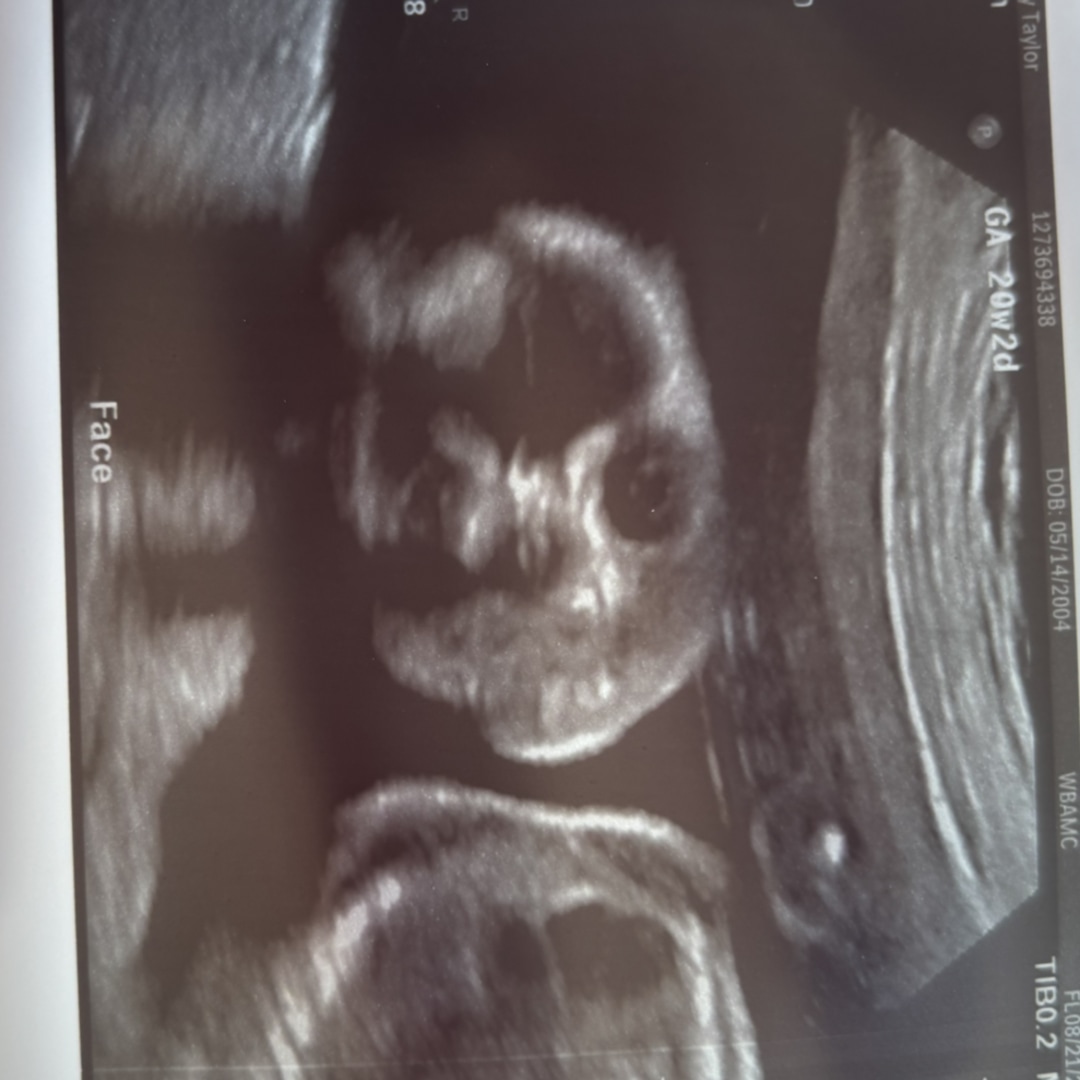 Photo shared by Briley for their Babylist baby registry.