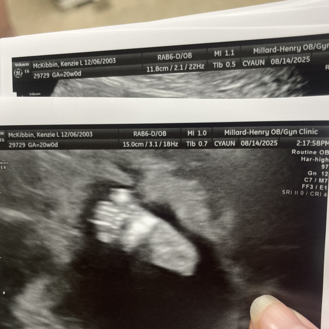 Photo shared by Kenzie for their Babylist baby registry.