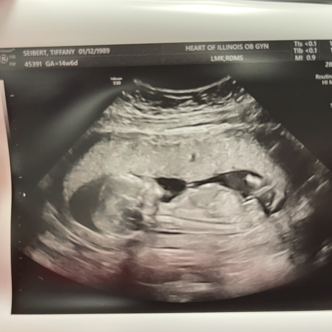 Photo shared by Tiffany for their Babylist baby registry.