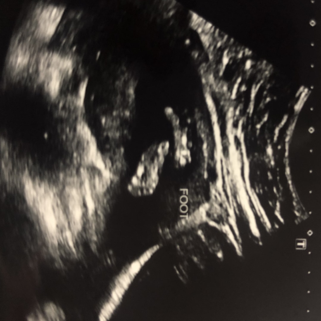Photo shared by Aubree for their Babylist baby registry.