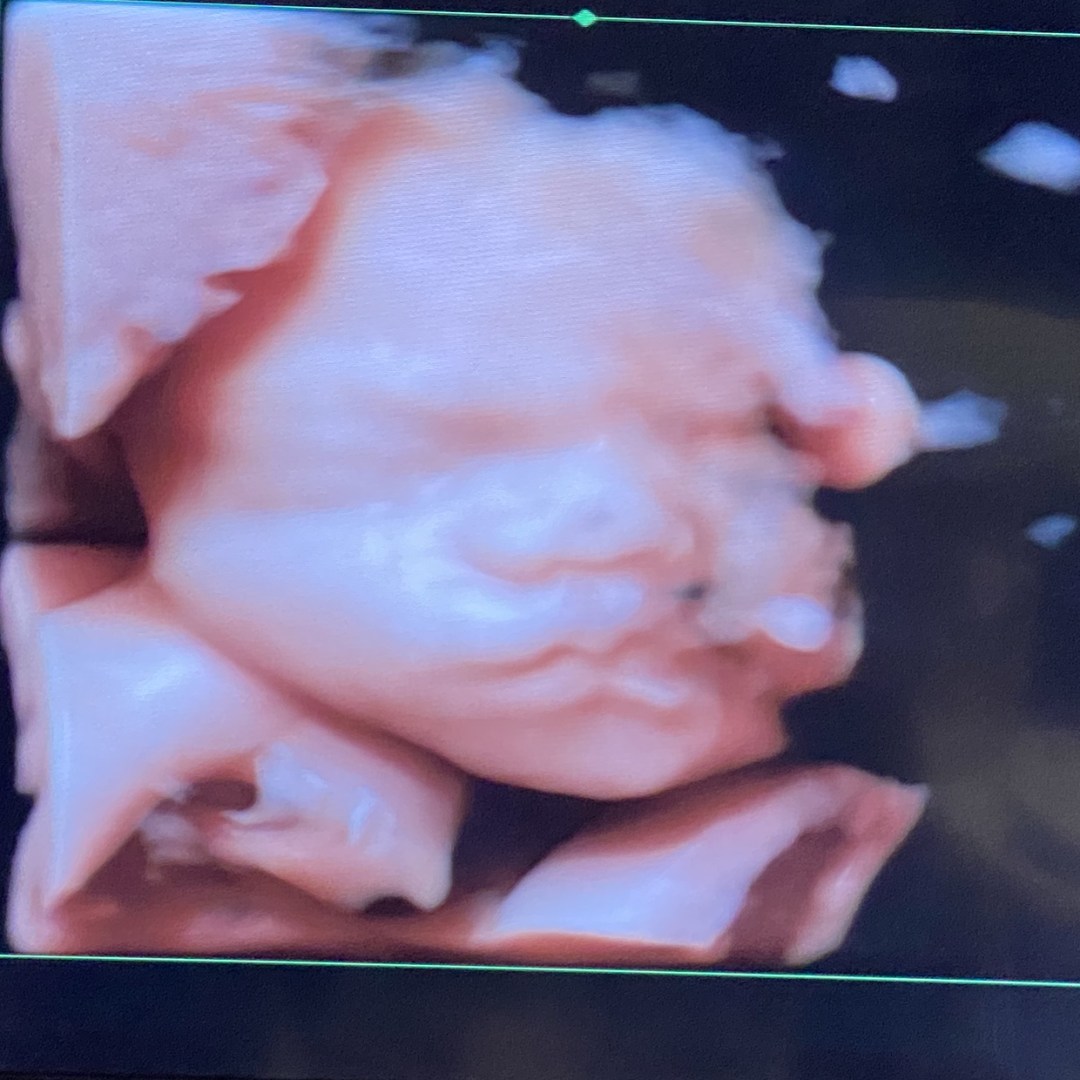 Photo shared by Maggie for their Babylist baby registry.