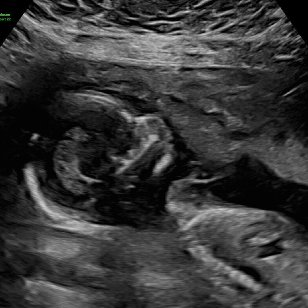 Photo shared by Leilani for their Babylist baby registry.