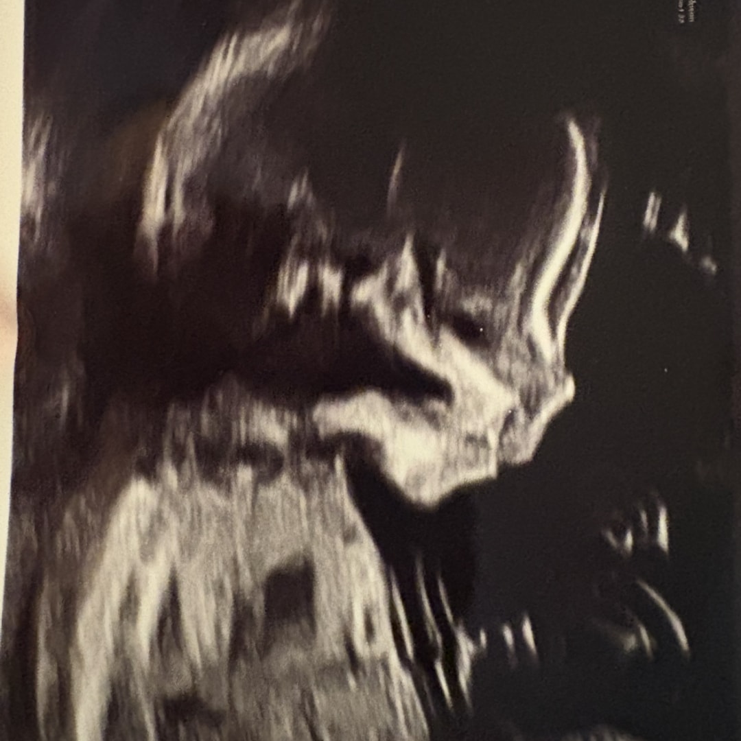 Photo shared by Renee for their Babylist baby registry.