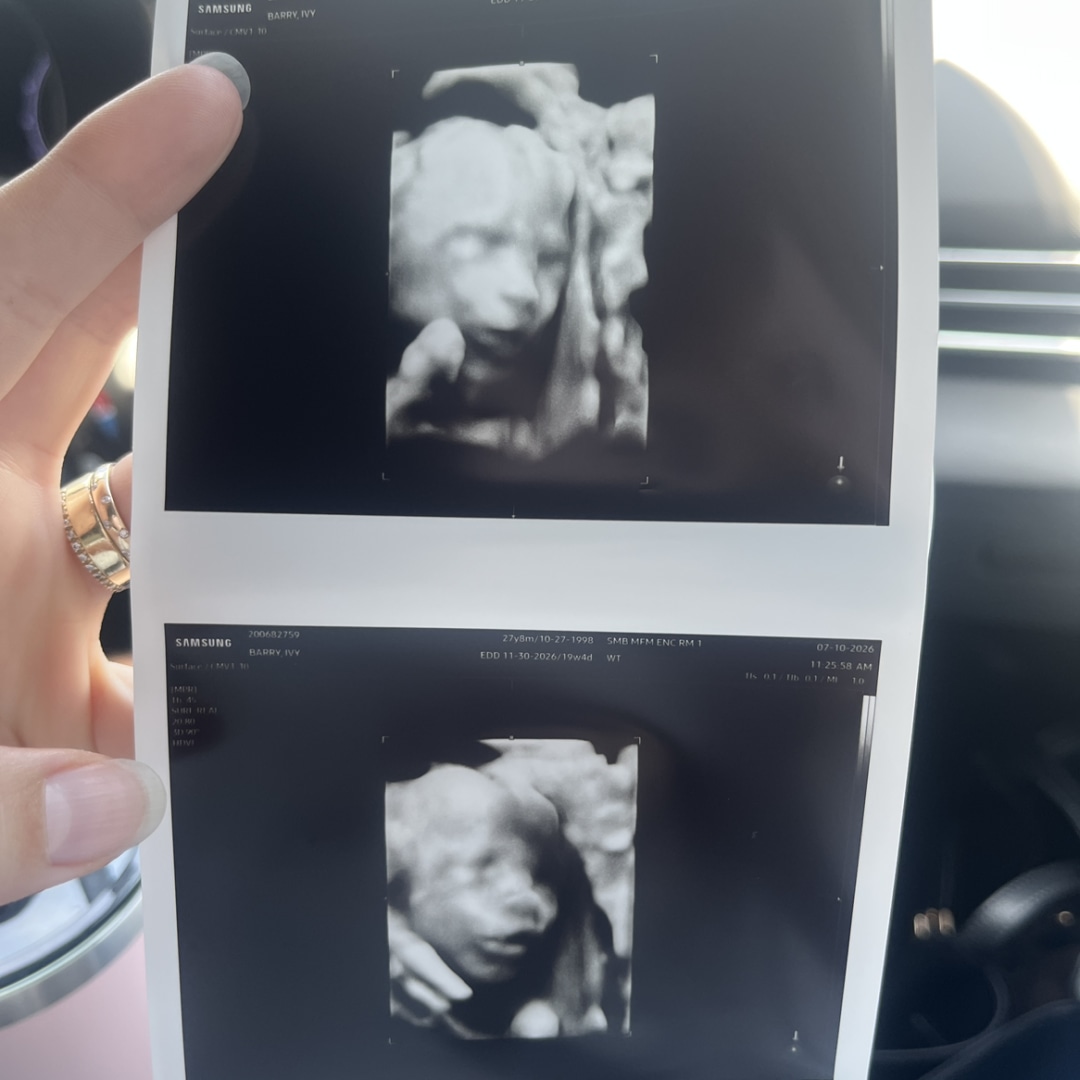Photo shared by Ivy for their Babylist baby registry.