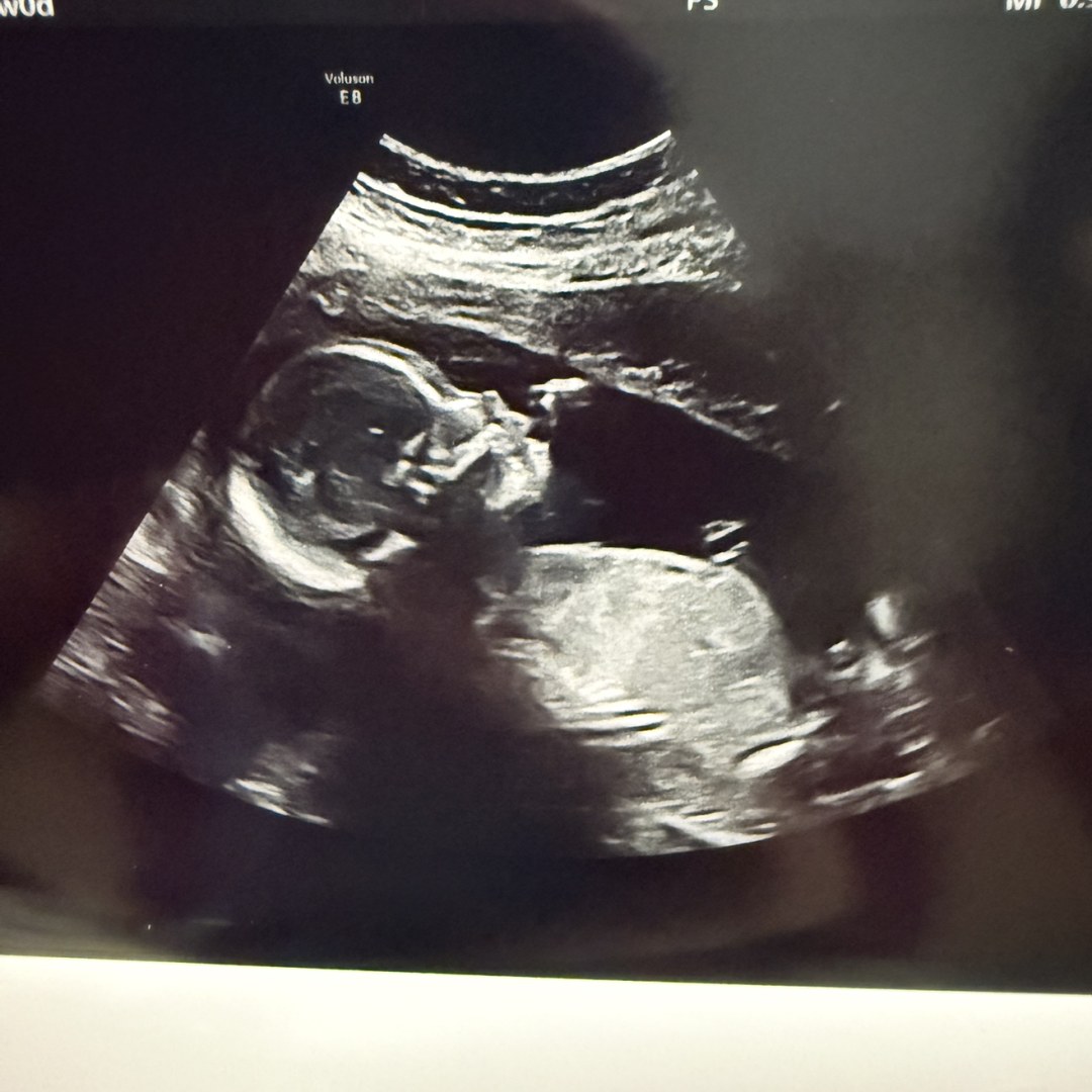 Photo shared by Shantalle for their Babylist baby registry.