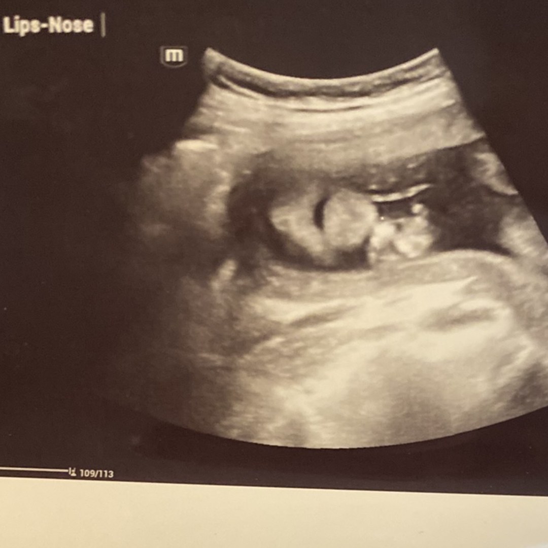 Photo shared by Paige for their Babylist baby registry.