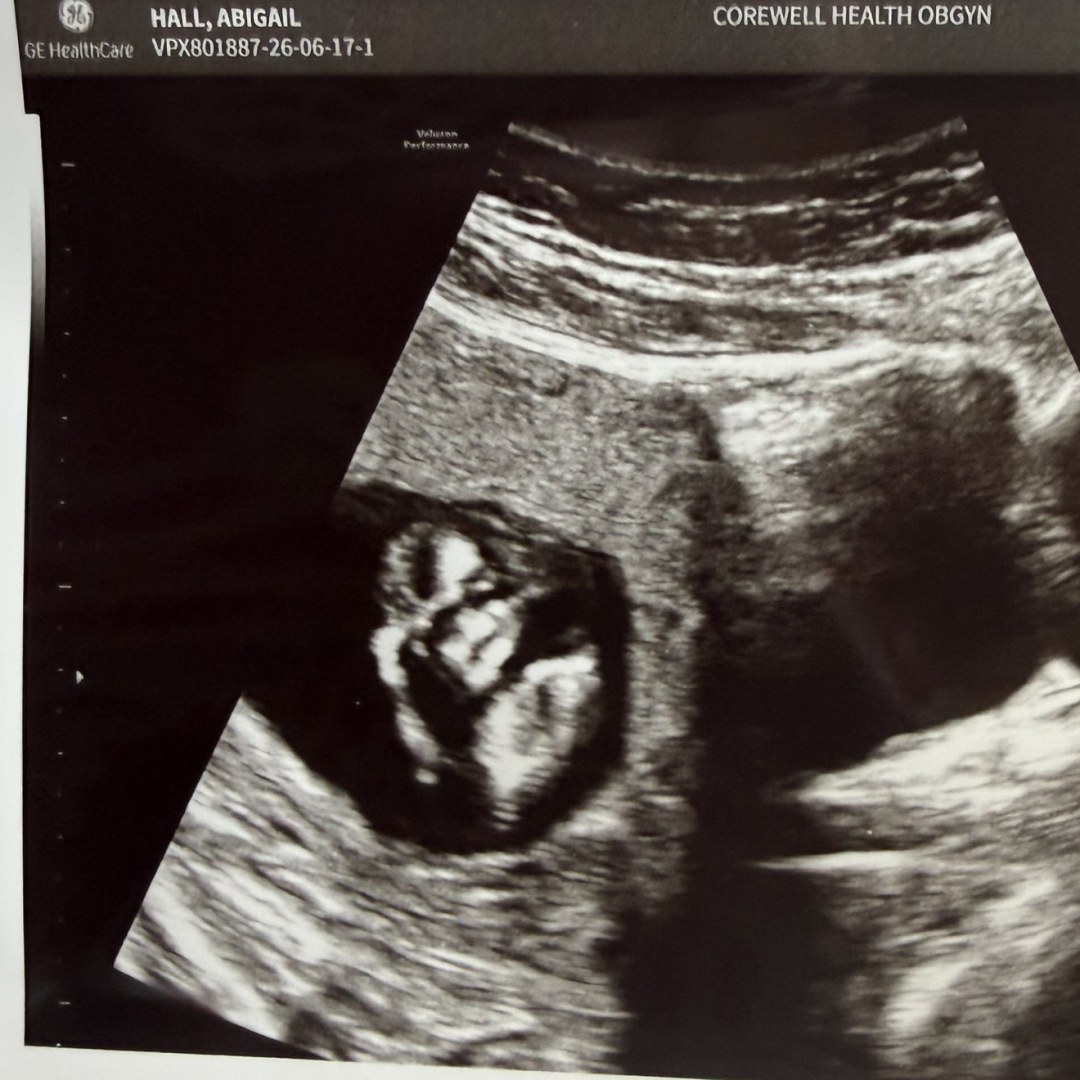 Photo shared by Abigail for their Babylist baby registry.