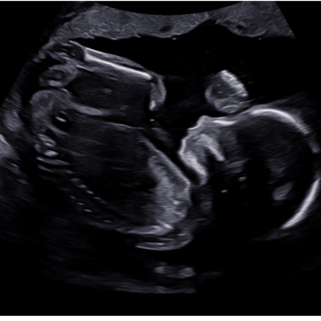 Photo shared by Rebecca for their Babylist baby registry.