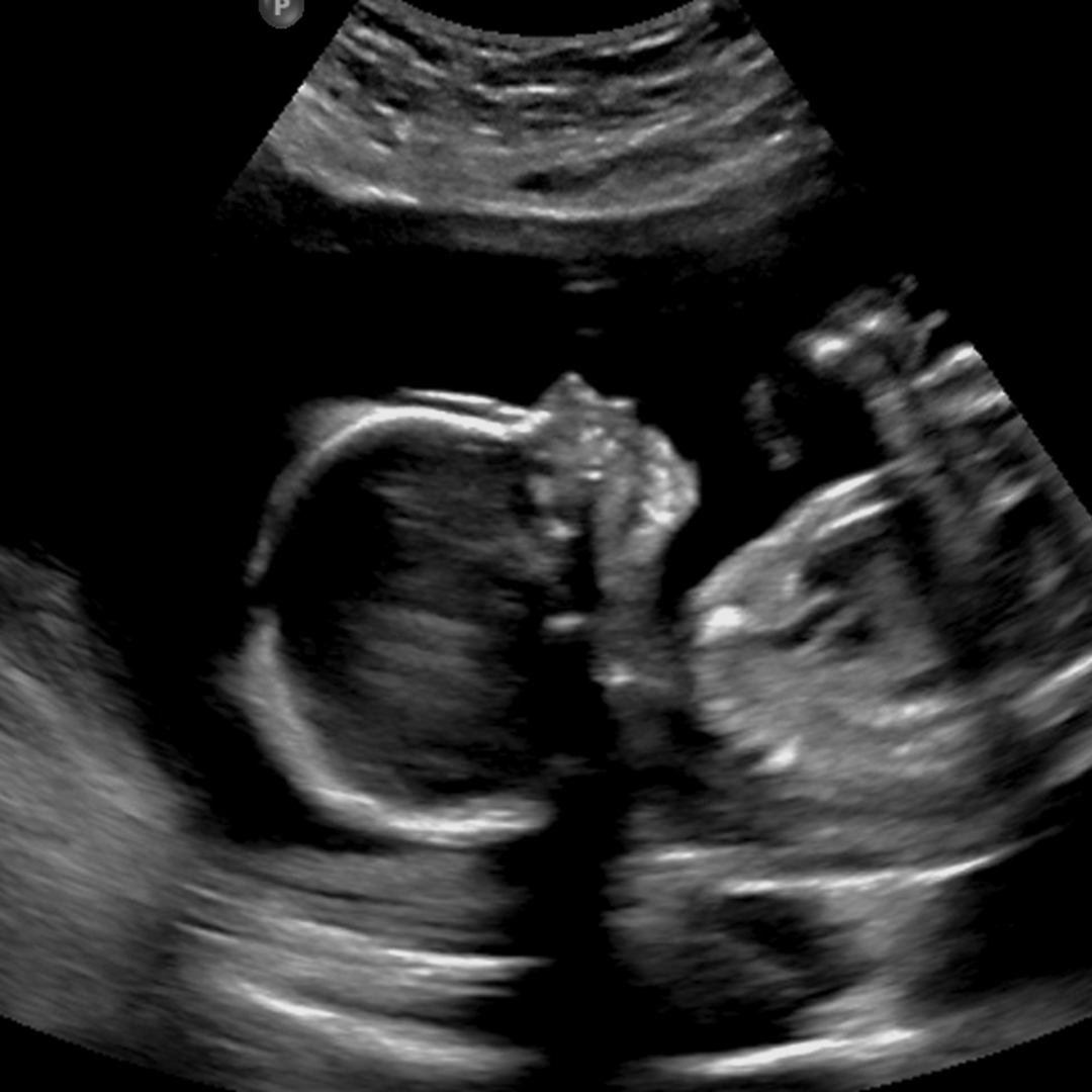 Photo shared by Clairae for their Babylist baby registry.
